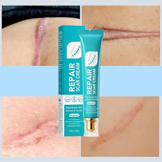 Crema para cicatriz